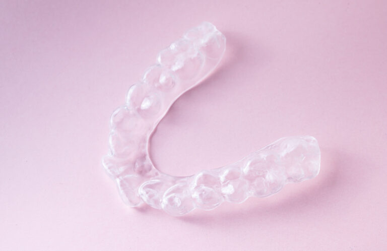 歯ぎしり・食いしばり・顎関節症の治療方法